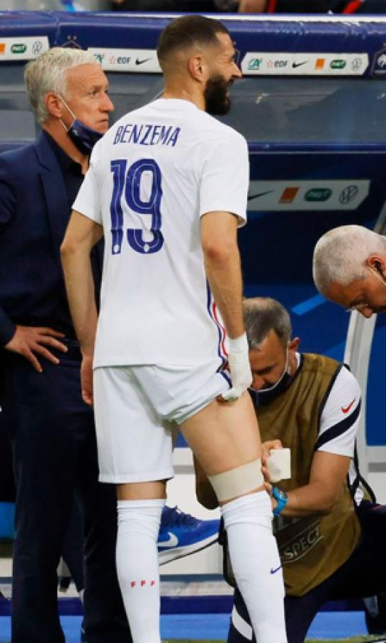 Karim Benzema estará listo para el debut de Francia en la Eurocopa