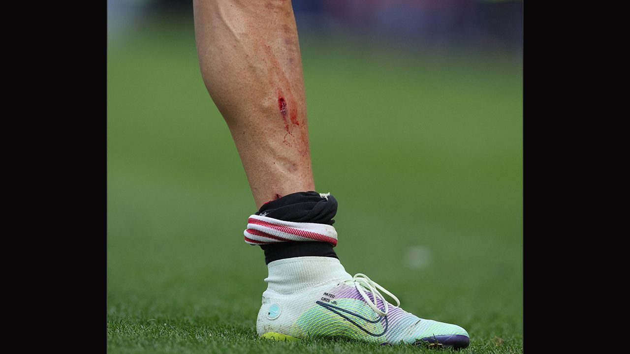 La herida que mostró que Cristiano Ronaldo no dejó de luchar