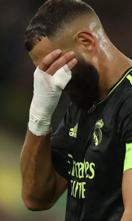Real Madrid se queda sin Karim Benzemá por un mes