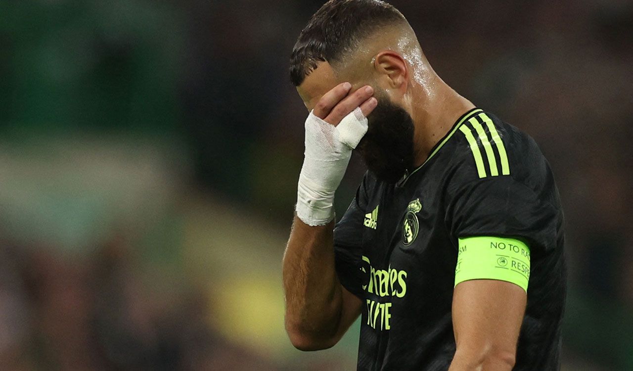 Real Madrid se queda sin Karim Benzemá por un mes
