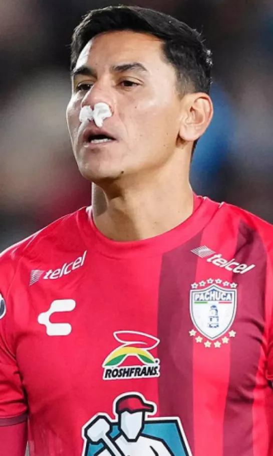 Oscar Ustari, sin daño cerebral de acuerdo con la Liga MX