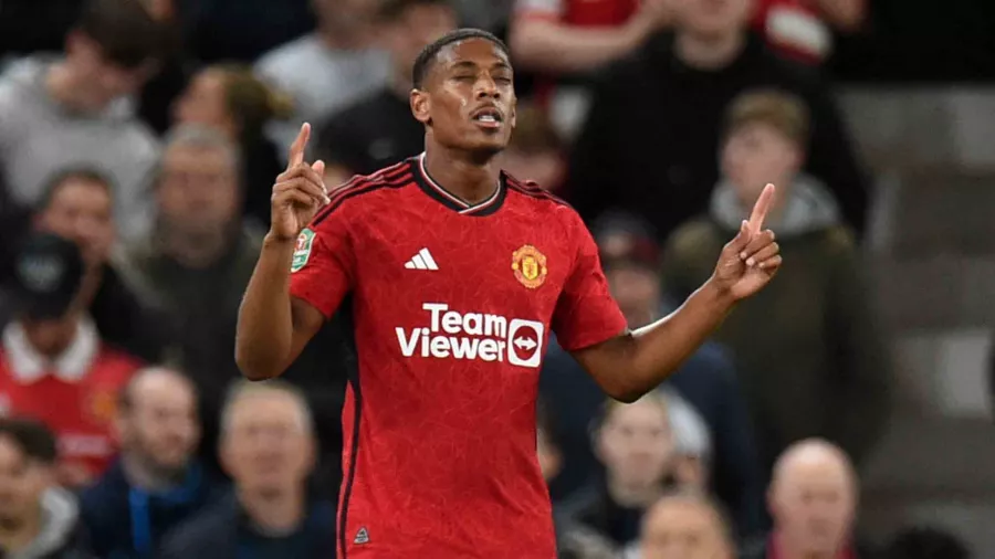 Anthony Martial, enfermo