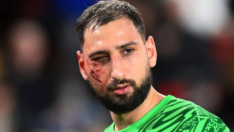 Gianluigi Donnarumma sufre un aparatoso corte en el rostro