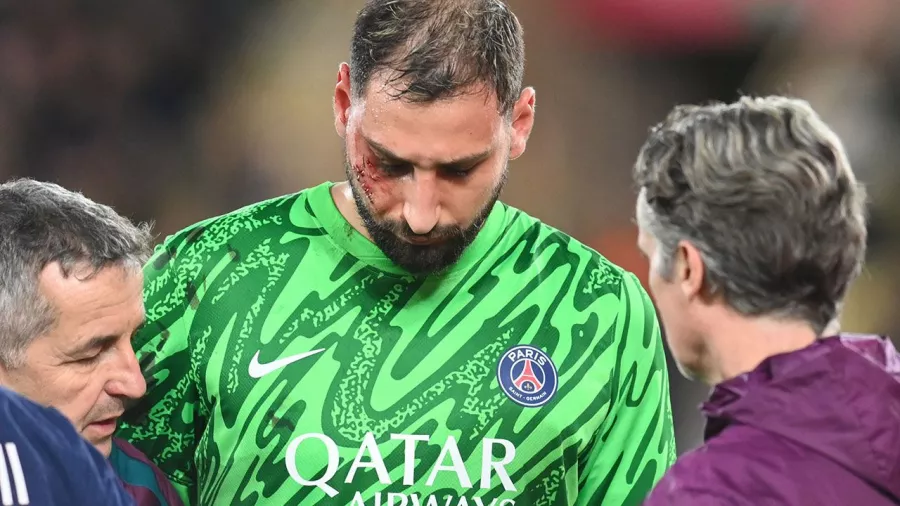 Gianluigi Donnarumma sufre un aparatoso corte en el rostro