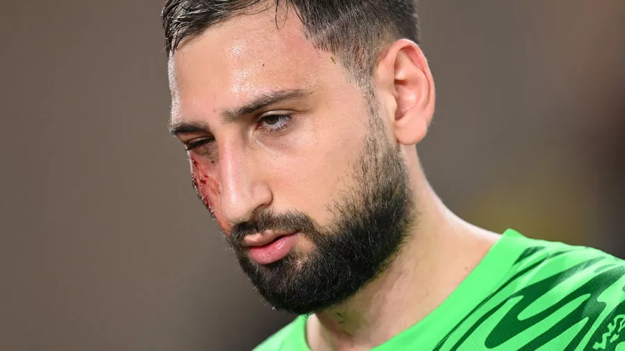 Gianluigi Donnarumma sufre un aparatoso corte en el rostro