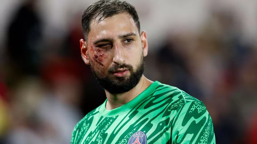 Gianluigi Donnarumma sufre un aparatoso corte en el rostro